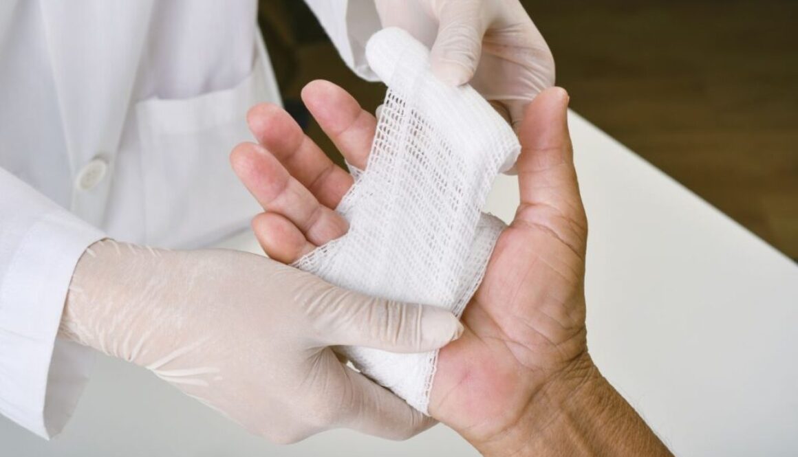 A doctor treating a denuded wound on the hand