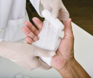 A doctor treating a denuded wound on the hand