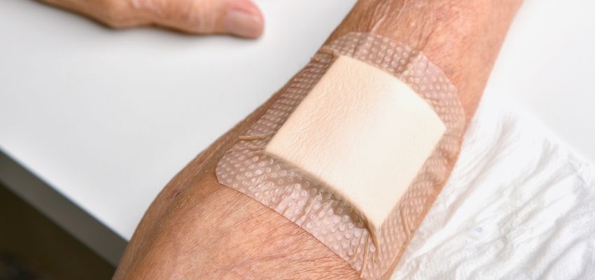 healing non-healing wounds (2) Proper wound care from the outset is key to preventing chronic wounds.