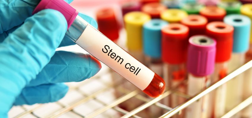 tissue regeneration therapy (1) During the procedure, stem cells are taken from the bone marrow or fat tissue and introduced into damaged areas.