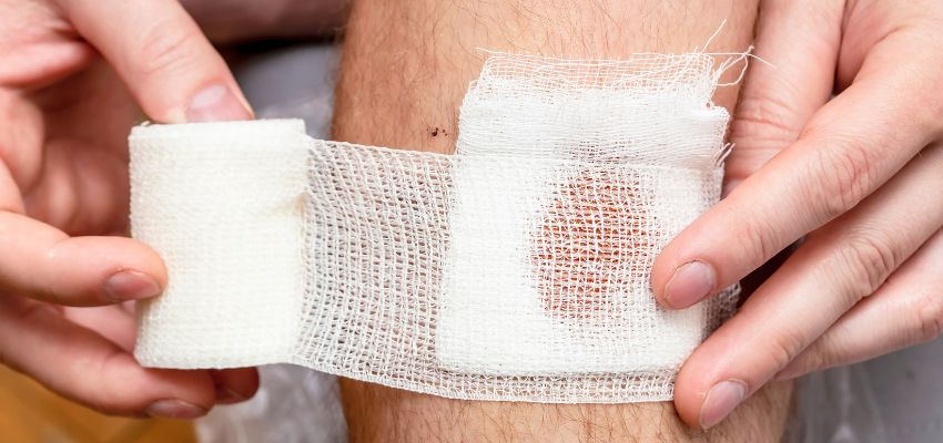 antimicrobial wound treatments (1) Antimicrobial wound treatments help combat infections, biofilms, and chronic wounds.