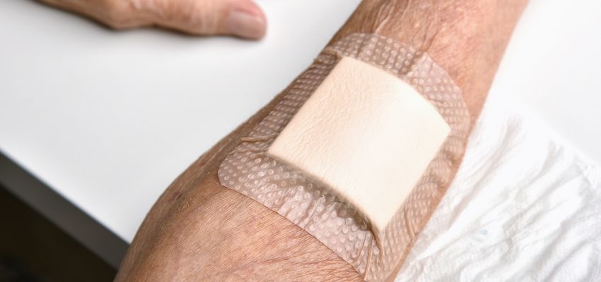 antimicrobial dressings (2) The antimicrobial dressings target bacteria directly at the wound.