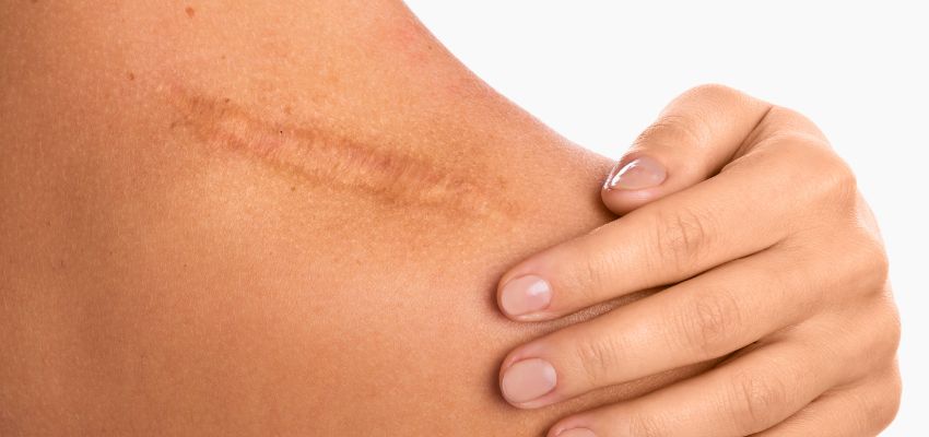 vitamin c for wound healing (3) Vitamin C contributes to a reduced risk of infections and promotes faster wound healing.