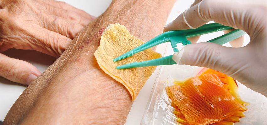 iodine-for-wounds2 Treatment with gauze soaked in iodine for wounds.