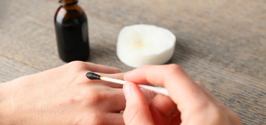 iodine-for-wounds4 Treatment involving iodine for wounds using cotton applicator.